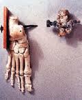 example of crucifixion foot and nail